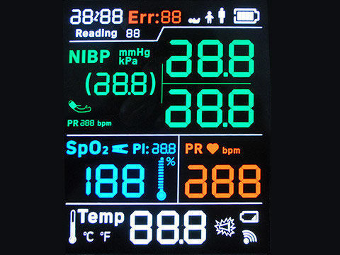 O painel LCD 128X64 monocromático do segmento de STN YG ST7565R 7 pontilha a solda de FPC